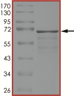 Sino Biological&nbsp;Recombinant Human Tau Protein (Tau-441 (P301L), AVI Tag), Biotinylated